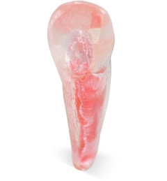 Endo 3DP™#11 Accessed Incisor (UL3)