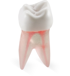 Real-T-Endo™ #14 Molar (UL6)