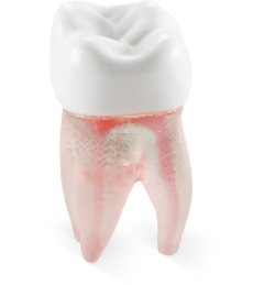 Real-T-Endo™ #03 Molar (UR6)