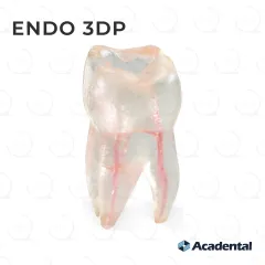Endo 3DP™ #03 Accessed Molar (UR6)