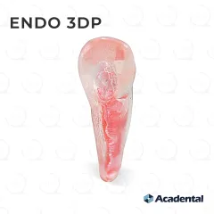 Endo 3DP™ #11 Accessed Incisor (UL3)