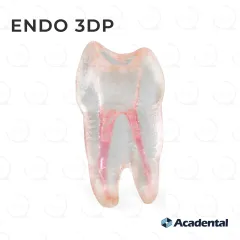 Endo 3DP™ #12 Accessed Premolar (UL4)