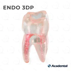 Endo 3DP™ #14 Accessed Molar (UL6)