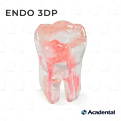Endo 3DP™ #30 Accessed Molar (LR6)