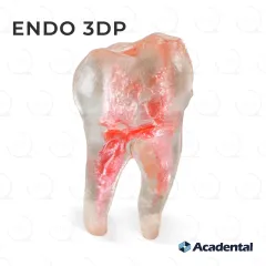 Endo 3DP™ #31 Accessed Molar (LR7)
