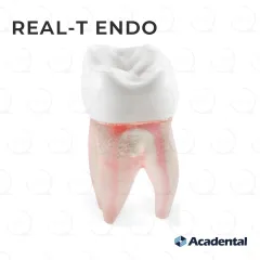 Real-T-Endo™ #03 Molar (UR6)