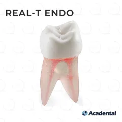 Real-T-Endo™ #14 Molar (UL6)
