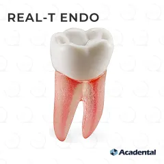 Real-T-Endo™ #19 Molar (LL6)