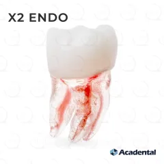 X2 Endo™ #30 Molar (LR6)